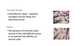 Aborizing Pattern BASICS IN DERMOSCOPY for clinical diagnosis | PPTX