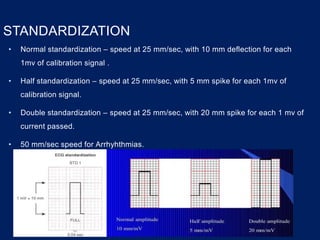 STANDARDIZATION
• Normal standardization – speed at 25 mm/sec, with 10 mm deflection for each
1mv of calibration signal .
• Half standardization – speed at 25 mm/sec, with 5 mm spike for each 1mv of
calibration signal.
• Double standardization – speed at 25 mm/sec, with 20 mm spike for each 1 mv of
current passed.
• 50 mm/sec speed for Arrhyhthmias.
 