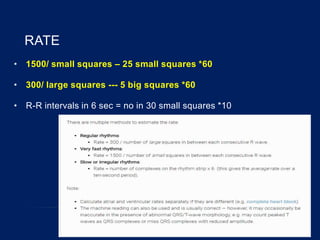 RATE
• 1500/ small squares – 25 small squares *60
• 300/ large squares --- 5 big squares *60
• R-R intervals in 6 sec = no in 30 small squares *10
 