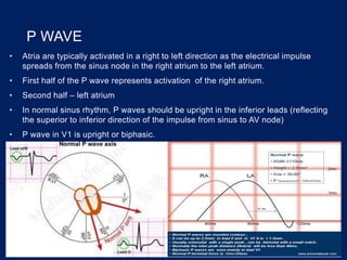 P WAVE
• Atria are typically activated in a right to left direction as the electrical impulse
spreads from the sinus node in the right atrium to the left atrium.
• First half of the P wave represents activation of the right atrium.
• Second half – left atrium
• In normal sinus rhythm, P waves should be upright in the inferior leads (reflecting
the superior to inferior direction of the impulse from sinus to AV node)
• P wave in V1 is upright or biphasic.
 