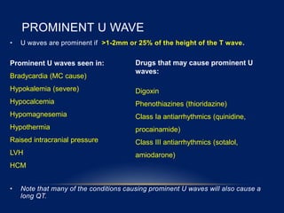 PROMINENT U WAVE
• U waves are prominent if >1-2mm or 25% of the height of the T wave.
• Note that many of the conditions causing prominent U waves will also cause a
long QT.
Drugs that may cause prominent U
waves:
Digoxin
Phenothiazines (thioridazine)
Class Ia antiarrhythmics (quinidine,
procainamide)
Class III antiarrhythmics (sotalol,
amiodarone)
Prominent U waves seen in:
Bradycardia (MC cause)
Hypokalemia (severe)
Hypocalcemia
Hypomagnesemia
Hypothermia
Raised intracranial pressure
LVH
HCM
 