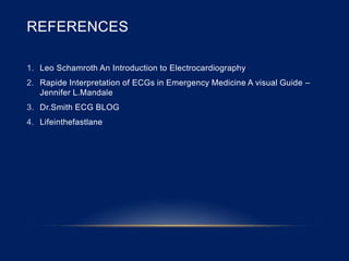 REFERENCES
1. Leo Schamroth An Introduction to Electrocardiography
2. Rapide Interpretation of ECGs in Emergency Medicine A visual Guide –
Jennifer L.Mandale
3. Dr.Smith ECG BLOG
4. Lifeinthefastlane
 