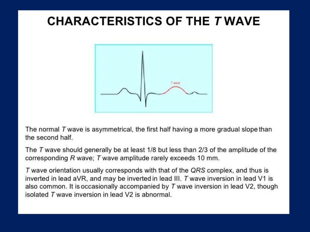 BASICS IN ELECTROCARDIOGRAPHY