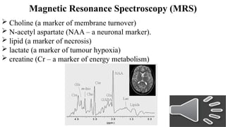Basics in MRI for young neurosurgeons.pptx