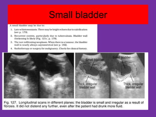 Basic skills of urinary tract ultrasound | PPT