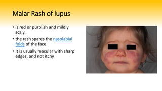 Basic skin lesions | PPTX