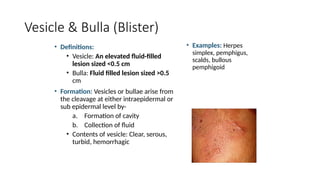 Comprehensive Overview of Basic Skin Lesions: Classification and ...