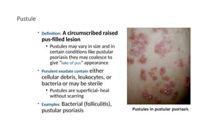 Comprehensive Overview of Basic Skin Lesions: Classification and ...
