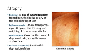 Comprehensive Overview of Basic Skin Lesions: Classification and ...