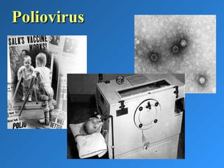 PoliovirusPoliovirus
 