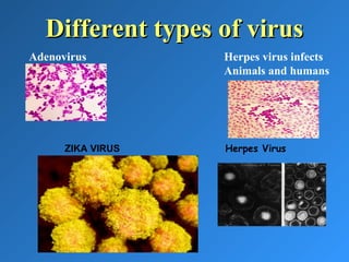 Different types of virusDifferent types of virus
Adenovirus Herpes virus infects
Animals and humans
Herpes VirusZIKA VIRUS
 