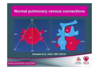 Darling Classification Basics of adult congenital heart disease assessment | PDF