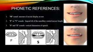 Basics for aesthetic smile | PPTX