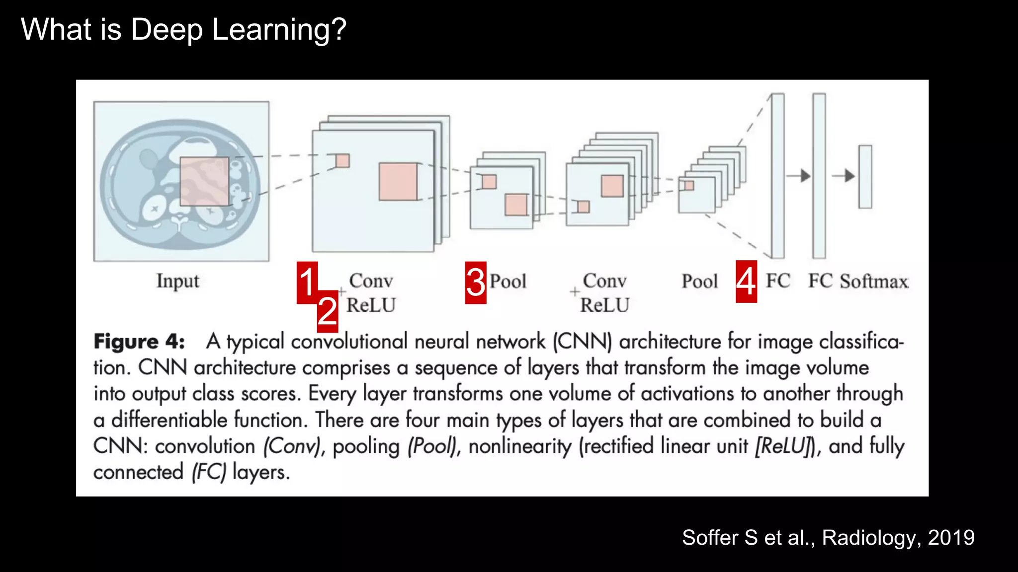 Soffer S et al., Radiology, 2019
What is Deep Learning?
1
2
3 4
 