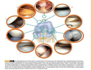 Basics of arthroscopy ppt | PPTX