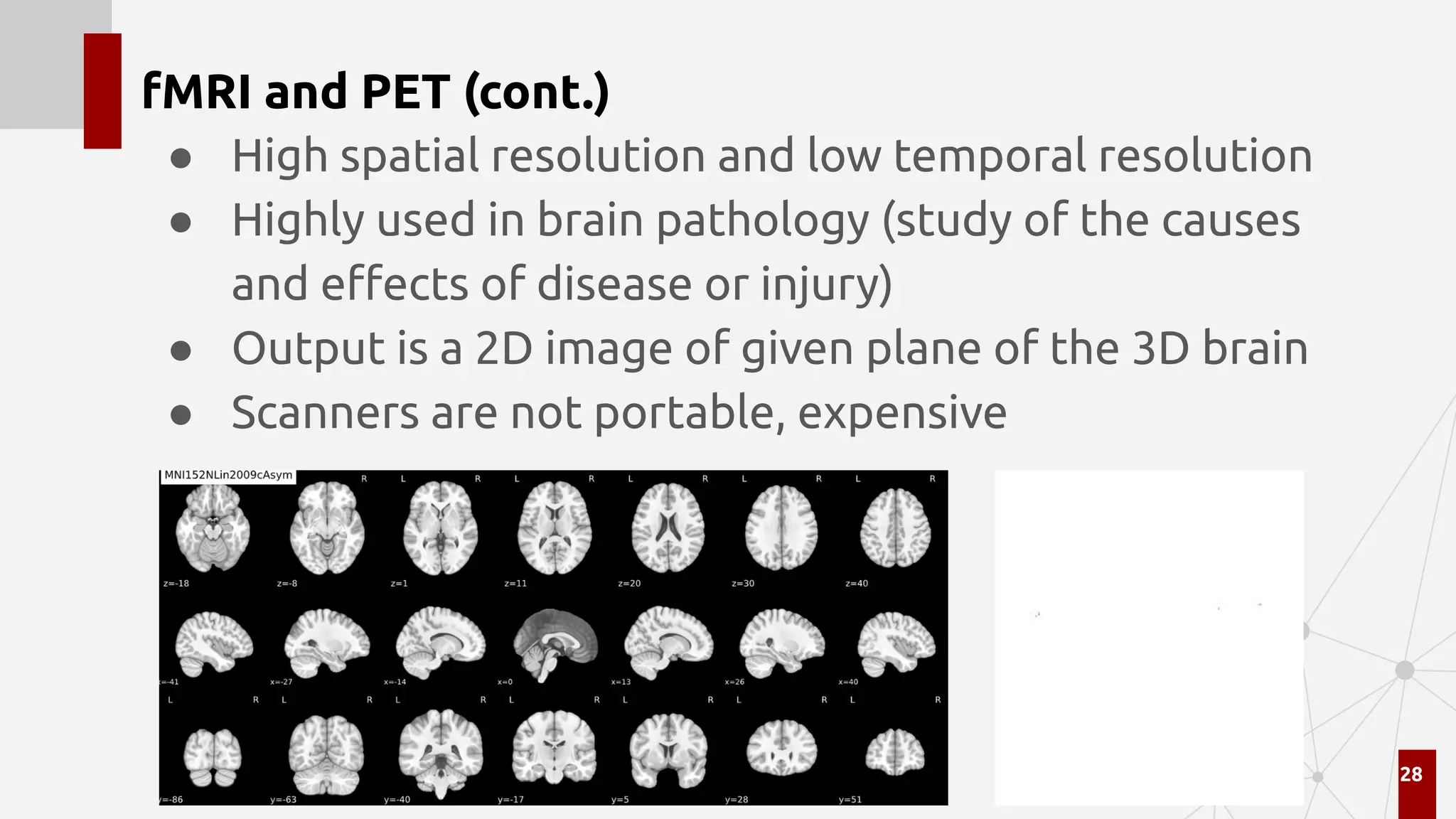 fMRI and PET (cont.)
● High spatial resolution and low temporal resolution
● Highly used in brain pathology (study of the causes
and eﬀects of disease or injury)
● Output is a 2D image of given plane of the 3D brain
● Scanners are not portable, expensive
28
 