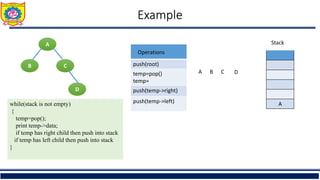 Example
A
B C
D
push(root)
temp=pop()
temp=
push(temp->right)
push(temp->left) A
Stack
Operations
A B C D
while(stack is not empty)
{
temp=pop();
print temp->data;
if temp has right child then push into stack
if temp has left child then push into stack
}
 