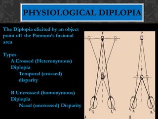BASICS OF BINOCULAR VISION----1.pptx