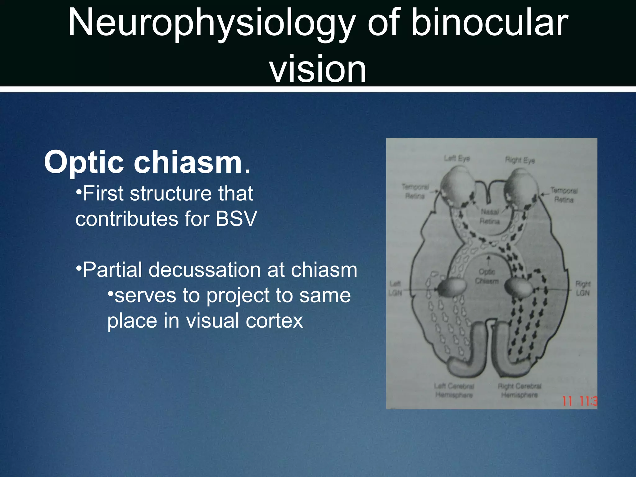 Neurophysiology of binocular
vision
Optic chiasm.
•First structure that
contributes for BSV
•Partial decussation at chiasm
•serves to project to same
place in visual cortex
 