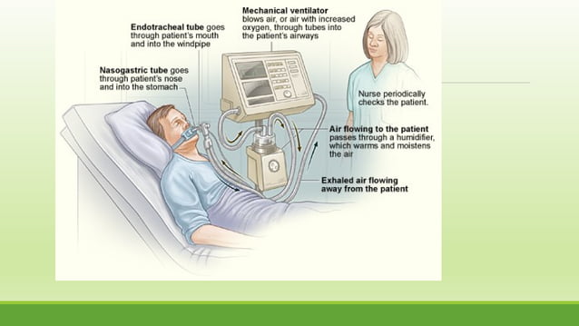 BASICS OF BIOMEDICAL INSTRUMENTATION | PPT