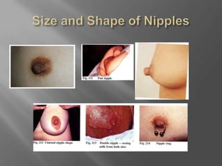 Size and Shape of Nipples
