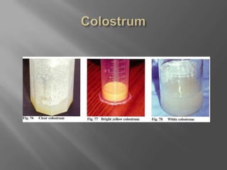 Colostrum