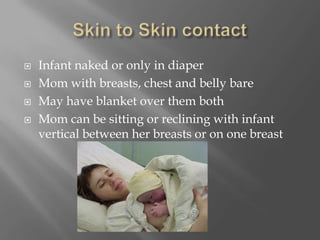 Skin to Skin contactInfant naked or only in diaperMom with breasts, chest and belly bareMay have blanket over them bothMom can be sitting or reclining with infant vertical between her breasts or on one breast