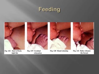 Feeding