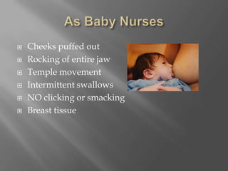 As Baby NursesCheeks puffed outRocking of entire jawTemple movementIntermittent swallowsNO clicking or smackingBreast tissue