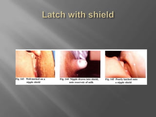 Latch with shield