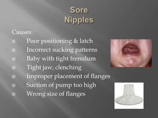 Sore NipplesCauses:     Poor positioning & latch     Incorrect sucking patterns     Baby with tight frenulum     Tight jaw, clenching     Improper placement of flanges     Suction of pump too high     Wrong size of flanges