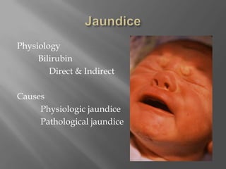 JaundicePhysiologyBilirubin	          Direct & IndirectCauses		  Physiologic jaundice		  Pathological jaundice