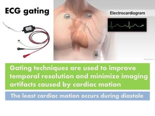ECG gating
The least cardiac motion occurs during diastole
Gating techniques are used to improve
temporal resolution and minimize imaging
artifacts caused by cardiac motion
 