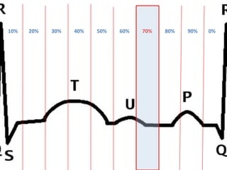 10% 20% 0%90%80%70%60%50%40%30%
 