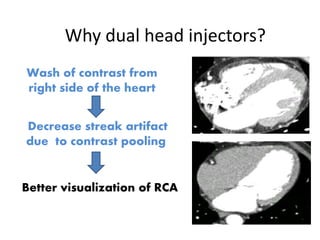 Wash of contrast from
right side of the heart
Decrease streak artifact
due to contrast pooling
Better visualization of RCA
Why dual head injectors?
 