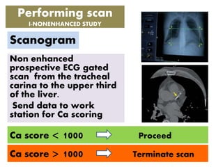 Performing scan
I-NONENHANCED STUDY
Non enhanced
prospective ECG gated
scan from the tracheal
carina to the upper third
of the liver.
Send data to work
station for Ca scoring
Ca score > 1000 Terminate scan
Ca score < 1000 Proceed
Scanogram
 