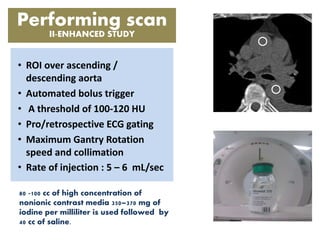 • ROI over ascending /
descending aorta
• Automated bolus trigger
• A threshold of 100-120 HU
• Pro/retrospective ECG gating
• Maximum Gantry Rotation
speed and collimation
• Rate of injection : 5 – 6 mL/sec
Performing scan
II-ENHANCED STUDY
80 -100 cc of high concentration of
nonionic contrast media 350–370 mg of
iodine per milliliter is used followed by
40 cc of saline.
 