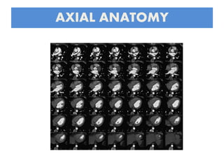 AXIAL ANATOMY
 