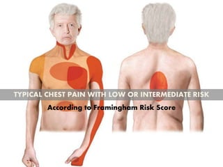 TYPICAL CHEST PAIN WITH LOW OR INTERMEDIATE RISK
According to Framingham Risk Score
 