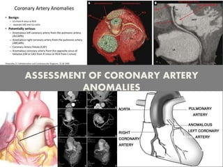 ASSESSMENT OF CORONARY ARTERY
ANOMALIES
 
