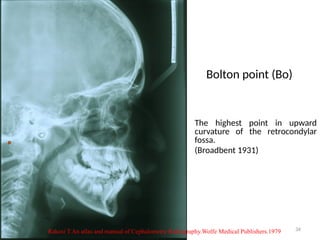 Comprehensive Overview of Basic Cephalometry in Orthodontics | PPTX