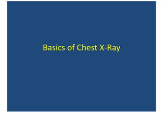 Basics Of Chest X-Ray