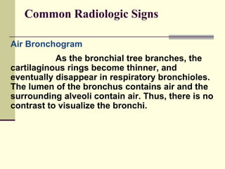 Basics of Chest X-ray Interpretation.pptx