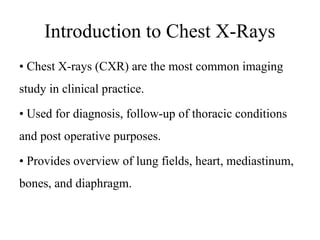 basics_of_chest_xray.pptx basic of chest x ray | PPTX