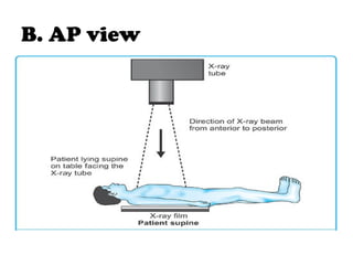 basics-of-chest-xray-pptx-basic-of-chest-x-ray-pptx