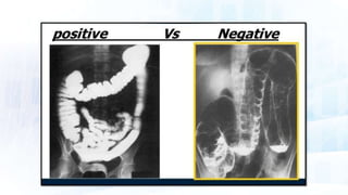 Basics of contrast media | PPTX