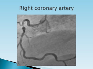 Basics of coronary angiography | PPTX