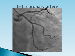 Basics of coronary angiography | PPTX
