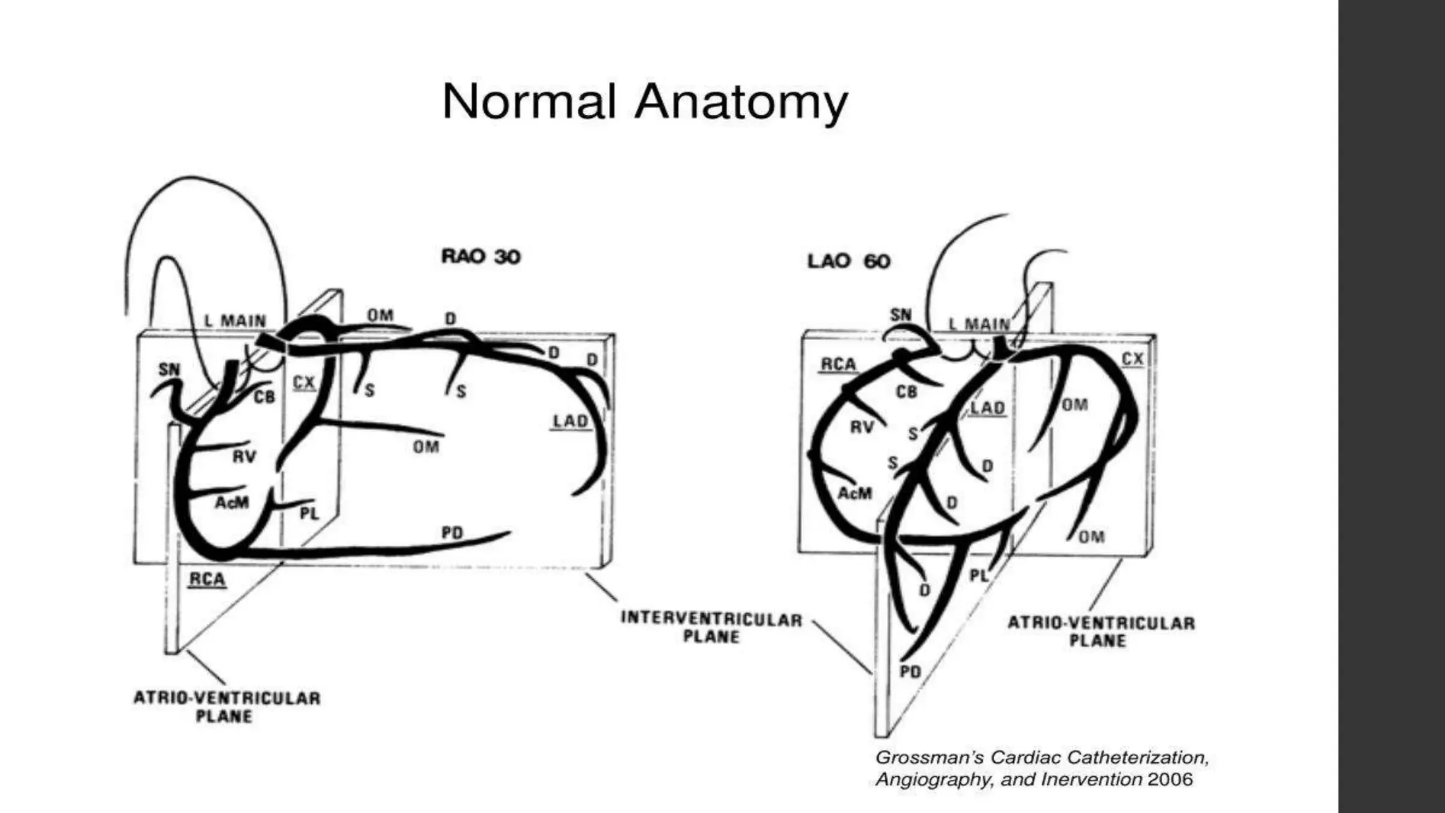 Basics of coronary artery anatomy and angiographic views | PPTX