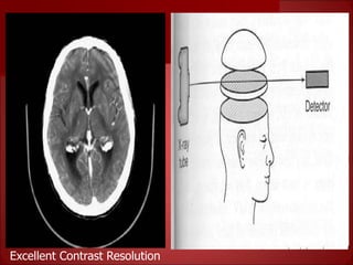 Basics of CT- Lecture 1.ppt
